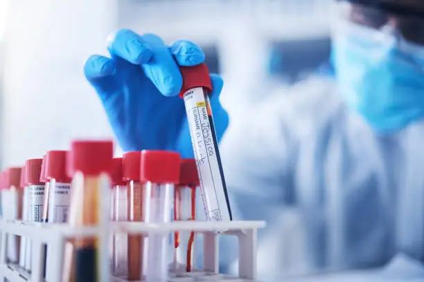 Wissenschaftliche Laborforschung mit Proben